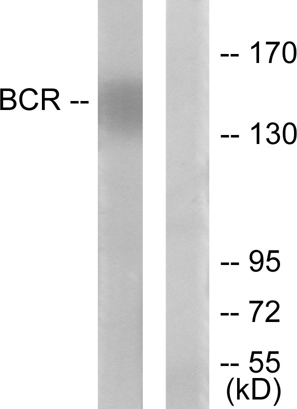 CML / BCR Antibody - Western blot analysis of lysates from K562 cells, using Bcr Antibody. The lane on the right is blocked with the synthesized peptide.