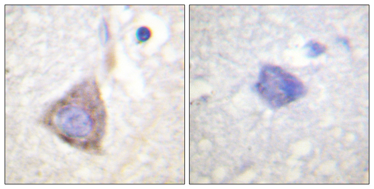 CML / BCR Antibody - Immunohistochemistry analysis of paraffin-embedded human brain tissue, using Bcr Antibody. The picture on the right is blocked with the synthesized peptide.
