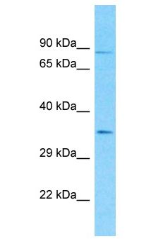 CML / BCR Antibody - Bcr-Abl antibody Western Blot of HCT15. Antibody dilution: 1 ug/ml.  This image was taken for the unconjugated form of this product. Other forms have not been tested.