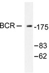 CML / BCR Antibody - Western blot of Bcr (D171) pAb in extracts from K562 cells.