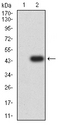CML / BCR Antibody - Western blot analysis using BCR mAb against HEK293 (1) and BCR (AA: 139-280)-hIgGFc transfected HEK293 (2) cell lysate.