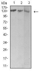 CML / BCR Antibody - Western blot analysis using BCR mouse mAb against Jurkat (1), Hela (2), and Ramos (3) cell lysate.