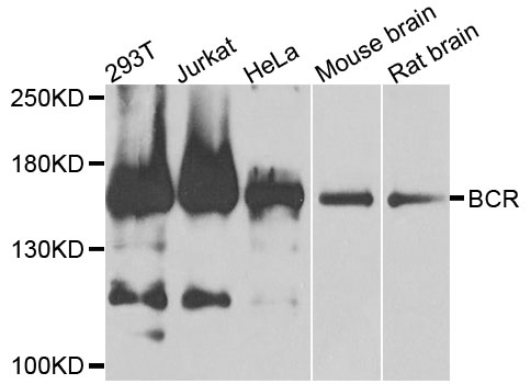CML / BCR Antibody - Western blot analysis of extracts of various cell lines, using BCR antibody at 1:1000 dilution. The secondary antibody used was an HRP Goat Anti-Rabbit IgG (H+L) at 1:10000 dilution. Lysates were loaded 25ug per lane and 3% nonfat dry milk in TBST was used for blocking. An ECL Kit was used for detection and the exposure time was 30s.