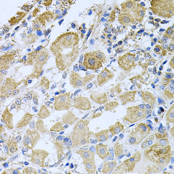 CML / BCR Antibody - Immunohistochemistry of paraffin-embedded human stomach using BCR antibodyat dilution of 1:100 (40x lens).