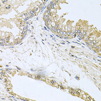 CML / BCR Antibody - Immunohistochemistry of paraffin-embedded human prostate using BCR antibodyat dilution of 1:100 (40x lens).