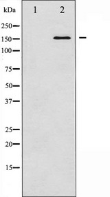 CML / BCR Antibody - Western blot analysis of Bcr expression in K562 whole cells lysates. The lane on the left is treated with the antigen-specific peptide.