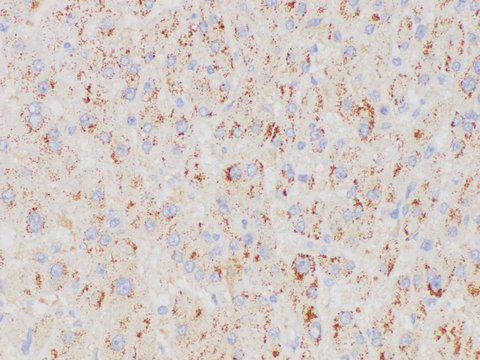 CML / BCR Antibody - Immunohistochemistry of paraffin-embedded Human liver using BCR Polycloanl Antibody at dilution of 1:200.