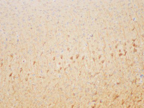 CML / BCR Antibody - Immunohistochemistry of paraffin-embedded Mouse brain using BCR Polycloanl Antibody at dilution of 1:200.