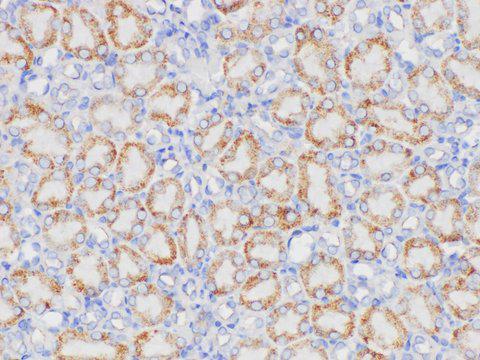 CML / BCR Antibody - Immunohistochemistry of paraffin-embedded Mouse kidney using BCR Polycloanl Antibody at dilution of 1:200.
