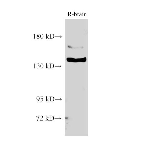 CML / BCR Antibody - Western Blot analysis of Rat brain using BCR Polyclonal Antibody at dilution of 1:1000.