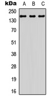 CML / BCR Antibody - Western blot analysis of BCR expression in HepG2 (A); mouse brain (B); rat brain (C) whole cell lysates.