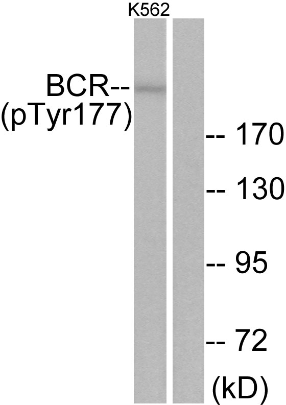 CML / BCR Antibody - Western blot analysis of lysates from K562 cells, using Bcr (Phospho-Tyr177) Antibody. The lane on the right is blocked with the phospho peptide.