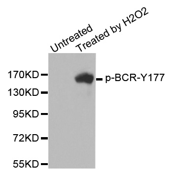 CML / BCR Antibody - Western blot analysis of extracts from K562 cells.