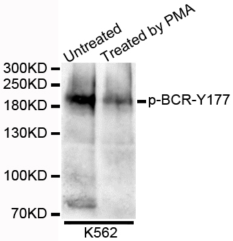 CML / BCR Antibody - Western blot analysis of extracts of K562 cells.