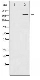 CML / BCR Antibody - Western blot of Bcr phosphorylation expression in K562 whole cell lysates,The lane on the left is treated with the antigen-specific peptide.