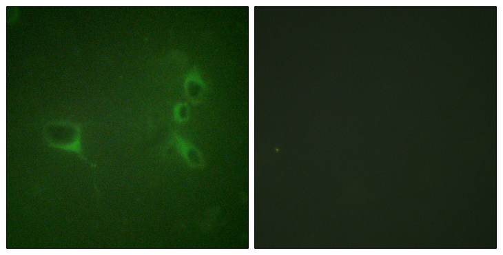 CML / BCR Antibody - Immunofluorescence analysis of NIH/3T3 cells, using Bcr (Phospho-Tyr360) Antibody. The picture on the right is blocked with the phospho peptide.
