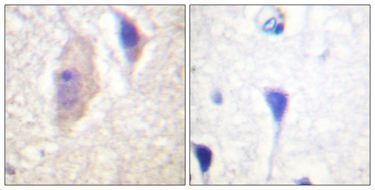 CML / BCR Antibody - Immunohistochemistry analysis of paraffin-embedded human brain, using Bcr (Phospho-Tyr360) Antibody. The picture on the right is blocked with the phospho peptide.