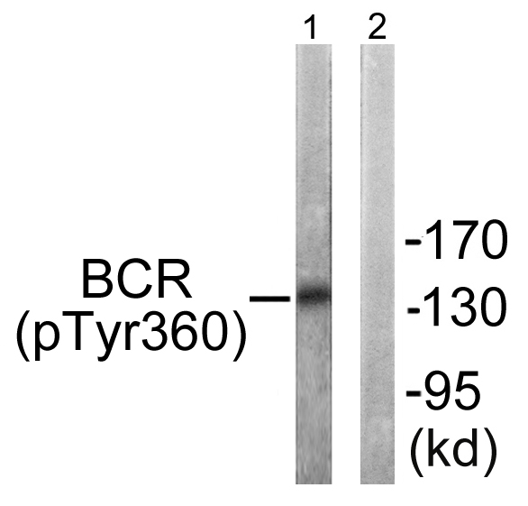 CML / BCR Antibody - Western blot analysis of lysates from COS7 cells, using Bcr (Phospho-Tyr360) Antibody. The lane on the right is blocked with the phospho peptide.