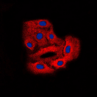 CML / BCR Antibody - Immunofluorescent analysis of BCR (pY360) staining in HeLa cells. Formalin-fixed cells were permeabilized with 0.1% Triton X-100 in TBS for 5-10 minutes and blocked with 3% BSA-PBS for 30 minutes at room temperature. Cells were probed with the primary antibody in 3% BSA-PBS and incubated overnight at 4 ??C in a humidified chamber. Cells were washed with PBST and incubated with a DyLight 594-conjugated secondary antibody (red) in PBS at room temperature in the dark. DAPI was used to stain the cell nuclei (blue).