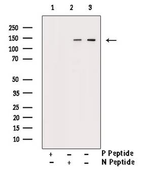 CML / BCR Antibody - Western blot analysis of Phospho-Bcr (Tyr360) antibody expression in COS7 cells lysates. The lane on the right is treated with the antigen-specific peptide.
