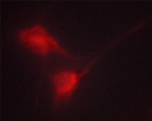 CML / BCR Antibody - Staining K562 cells by IF/ICC. The samples were fixed with PFA and permeabilized in 0.1% saponin prior to blocking in 10% serum for 45 min at 37°C. The primary antibody was diluted 1/400 and incubated with the sample for 1 hour at 37°C. A Alexa Fluor® 594 conjugated goat polyclonal to rabbit IgG (H+L), diluted 1/600 was used as secondary antibody.