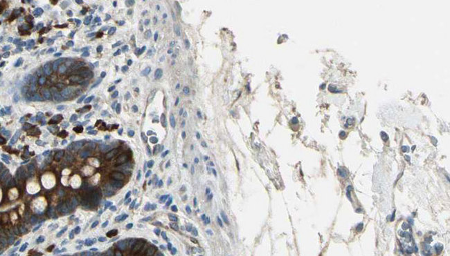 CML / BCR Antibody - 1:100 staining mouse intestine tissue by IHC-P. The sample was formaldehyde fixed and a heat mediated antigen retrieval step in citrate buffer was performed. The sample was then blocked and incubated with the antibody for 1.5 hours at 22°C. An HRP conjugated goat anti-rabbit antibody was used as the secondary.