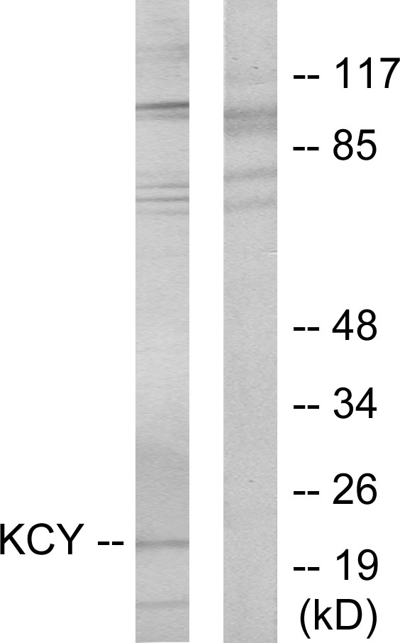 CMPK / CMPK1 Antibody - Western blot analysis of lysates from HeLa cells, using KCY Antibody. The lane on the right is blocked with the synthesized peptide.