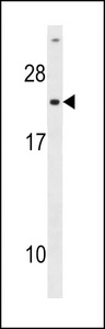 CMPK / CMPK1 Antibody - The anti-UCK antibody is used in Western blot to detect UCK in HepG2 cell lysate (Lane 1) and mouse cerebellum tissue lysate (Lane 2).
