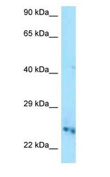 CMPK / CMPK1 Antibody - CMPK / CMPK1 antibody Western Blot of Mouse Heart.  This image was taken for the unconjugated form of this product. Other forms have not been tested.