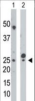 CMPK / CMPK1 Antibody - The anti-UCK antibody is used in Western blot to detect UCK in mouse cerebellum tissue lysate (Lane 1) and HepG2 cell lysate (Lane 2).