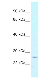CMPK / CMPK1 Antibody - CMPK / CMPK1 antibody Western Blot of Fetal Liver. Antibody dilution: 1 ug/ml.  This image was taken for the unconjugated form of this product. Other forms have not been tested.