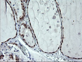 CMPK / CMPK1 Antibody - IHC of paraffin-embedded Human thyroid tissue using anti-CMPK1 mouse monoclonal antibody.