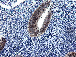 CMPK / CMPK1 Antibody - IHC of paraffin-embedded Human endometrium tissue using anti-CMPK1 mouse monoclonal antibody.