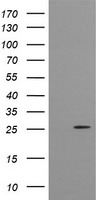 CMPK / CMPK1 Antibody - HEK293T cells were transfected with the pCMV6-ENTRY control (Left lane) or pCMV6-ENTRY CMPK1 (Right lane) cDNA for 48 hrs and lysed. Equivalent amounts of cell lysates (5 ug per lane) were separated by SDS-PAGE and immunoblotted with anti-CMPK1.