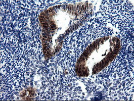 CMPK / CMPK1 Antibody - IHC of paraffin-embedded Human endometrium tissue using anti-CMPK1 mouse monoclonal antibody.