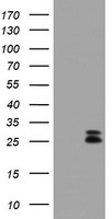 CMPK / CMPK1 Antibody - HEK293T cells were transfected with the pCMV6-ENTRY control (Left lane) or pCMV6-ENTRY CMPK1 (Right lane) cDNA for 48 hrs and lysed. Equivalent amounts of cell lysates (5 ug per lane) were separated by SDS-PAGE and immunoblotted with anti-CMPK1.