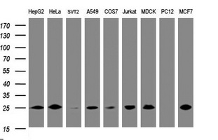 CMPK / CMPK1 Antibody - Western blot of extracts (35 ug) from 9 different cell lines by using anti-CMPK1 monoclonal antibody (HepG2: human; HeLa: human; SVT2: mouse; A549: human; COS7: monkey; Jurkat: human; MDCK: canine; PC12: rat; MCF7: human).