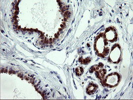 CMPK / CMPK1 Antibody - IHC of paraffin-embedded Human breast tissue using anti-CMPK1 mouse monoclonal antibody.