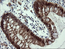 CMPK / CMPK1 Antibody - IHC of paraffin-embedded Human colon tissue using anti-CMPK1 mouse monoclonal antibody.
