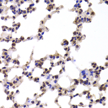 CMPK / CMPK1 Antibody - Immunohistochemistry of paraffin-embedded Mouse lung tissue.