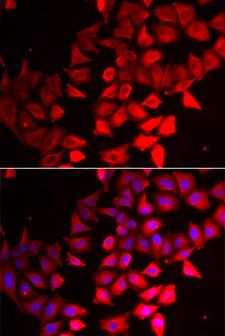 CMPK / CMPK1 Antibody - Immunofluorescence analysis of HeLa cells.