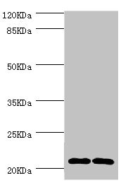 CMPK / CMPK1 Antibody - Western blot All Lanes:CMPK1 antibody at 3.55ug/ml Lane 1:293T whole cell lysate Lane 2:Hela whole cell lysate Secondary Goat polyclonal to rabbit at 1/10000 dilution Predicted band size: 23,17 kDa Observed band size: 22 kDa