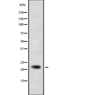 CMPK / CMPK1 Antibody - Western blot analysis UMP-CMP Kinase using HeLa whole cells lysates