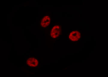 CMPK / CMPK1 Antibody - Staining HeLa cells by IF/ICC. The samples were fixed with PFA and permeabilized in 0.1% Triton X-100, then blocked in 10% serum for 45 min at 25°C. The primary antibody was diluted at 1:200 and incubated with the sample for 1 hour at 37°C. An Alexa Fluor 594 conjugated goat anti-rabbit IgG (H+L) Ab, diluted at 1/600, was used as the secondary antibody.