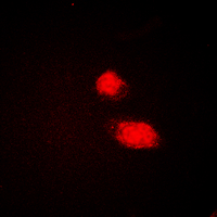 CMPK / CMPK1 Antibody - Immunofluorescent analysis of CMPK1 staining in HEK293T cells. Formalin-fixed cells were permeabilized with 0.1% Triton X-100 in TBS for 5-10 minutes and blocked with 3% BSA-PBS for 30 minutes at room temperature. Cells were probed with the primary antibody in 3% BSA-PBS and incubated overnight at 4 ??C in a humidified chamber. Cells were washed with PBST and incubated with a DyLight 594-conjugated secondary antibody (red) in PBS at room temperature in the dark. DAPI was used to stain the cell nuclei (blue).