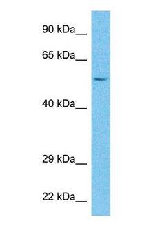 CMPK2 Antibody - Western blot of CMPK2 Antibody with human Fetal Liver lysate.  This image was taken for the unconjugated form of this product. Other forms have not been tested.