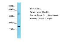 CMSS1 Antibody -  This image was taken for the unconjugated form of this product. Other forms have not been tested.