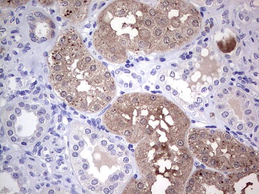 CMT2 / MAD2L1BP Antibody - IHC of paraffin-embedded Human Kidney tissue using anti-MAD2L1BP mouse monoclonal antibody. (Heat-induced epitope retrieval by 1 mM EDTA in 10mM Tris, pH8.5, 120°C for 3min).