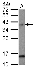 CMT2 / MAD2L1BP Antibody - Sample (30 ug of whole cell lysate) A: HepG2 12% SDS PAGE MAD2L1BP antibody diluted at 1:1000