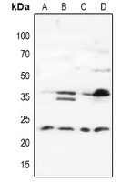 CMT2 / MAD2L1BP Antibody - Western blot analysis of MAD2L1BP expression in HEK293T (A), Hela (B), A549 (C), K562 (D) whole cell lysates.